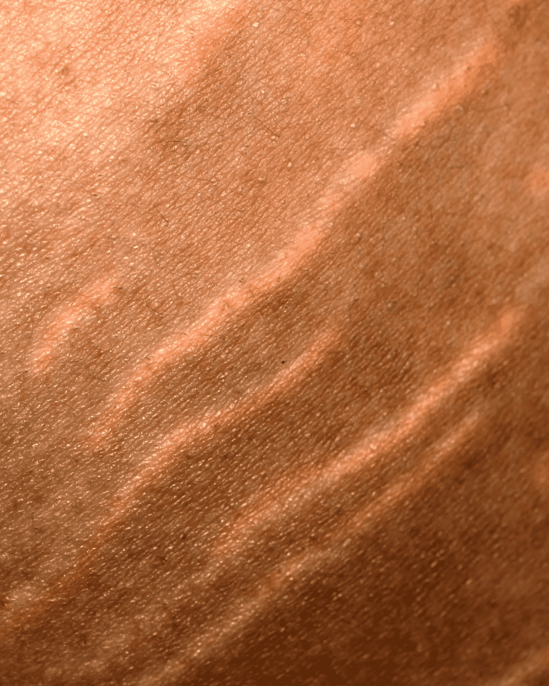 Le collagène Apnée