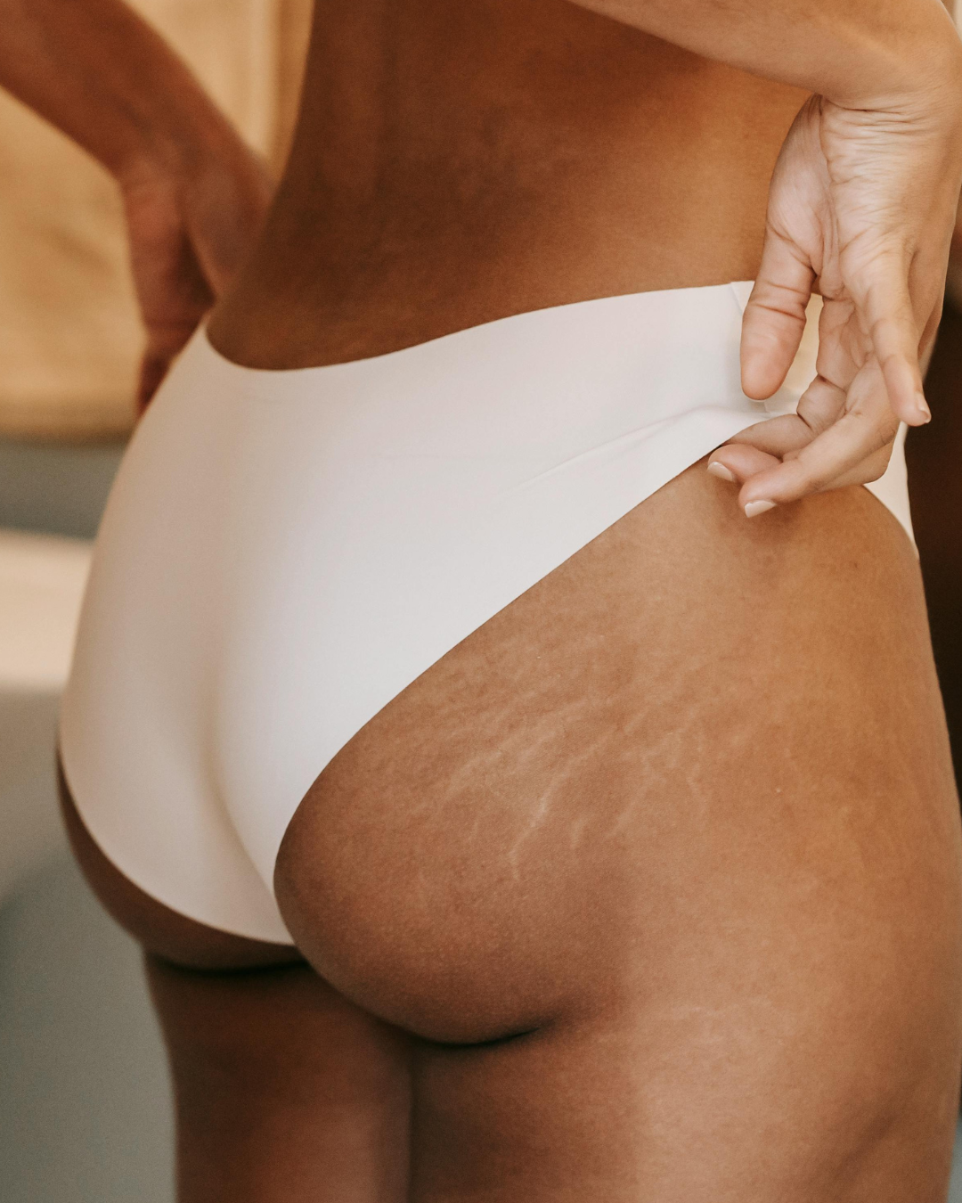 Enlever la cellulite : solutions pour lisser la peau